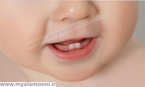 فروش انواع دندان گیر کودک به صورت عمده