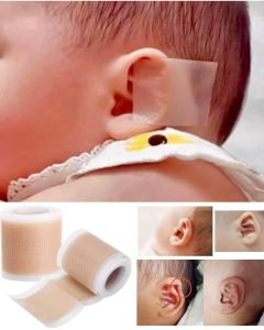 چسب فرم دهی گوش نوزاد 2 در 100 سانت